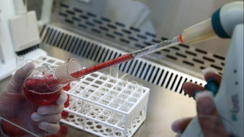 Bu kan gruplarındakiler dikkat! Felç riskiniz yüksek olabilir - Resim: 12