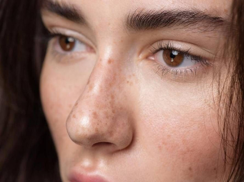 Uzman isim uyardı: Bu hata cilt lekelerine neden oluyor! - Resim: 12